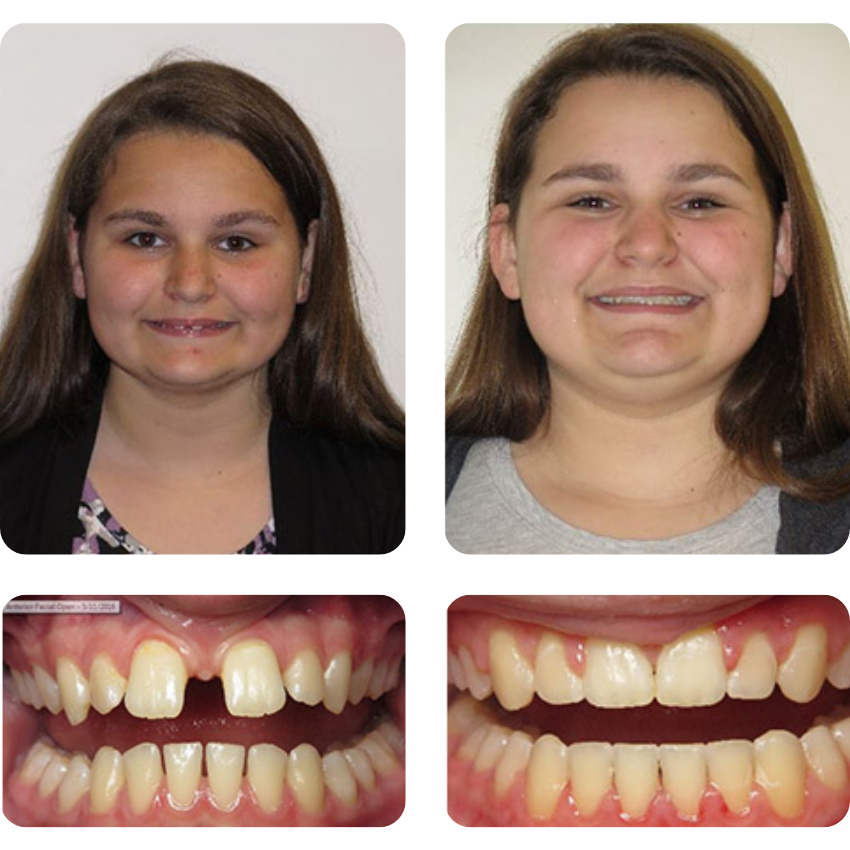 before-after
